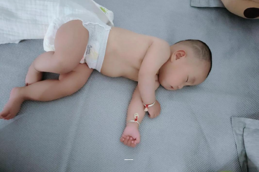 重庆宝宝上火有眼屎